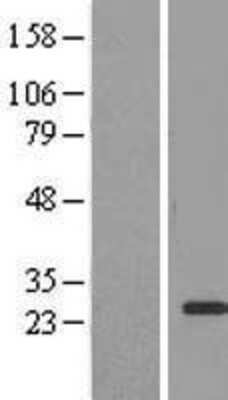 Western Blot: EEF1B2 Overexpression Lysate [NBL1-10123]