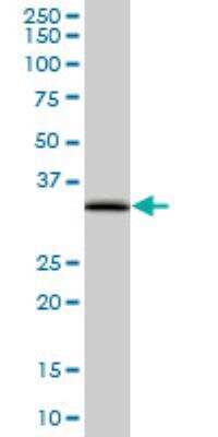 Western Blot: EEF1D Antibody (4B12) [H00001936-M04]