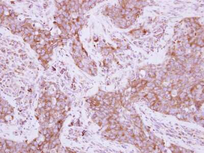 Immunohistochemistry-Paraffin: EEF1D Antibody [NBP2-16273]