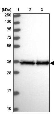 Western Blot: EEF1D Antibody [NBP1-91861]