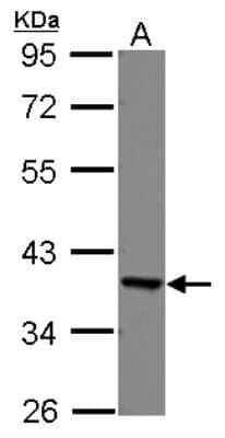 Western Blot: EEF1D Antibody [NBP2-16273]