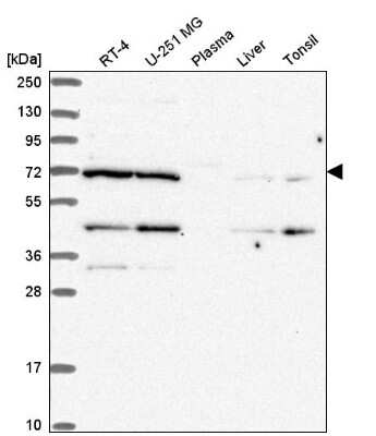 Western Blot: EEF1D Antibody [NBP2-56820]