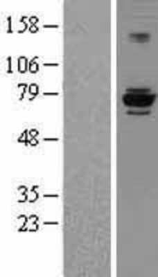 Western Blot: EEF1D Overexpression Lysate [NBP2-08159]