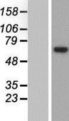 Western Blot: EEF1D Overexpression Lysate [NBP2-09501]