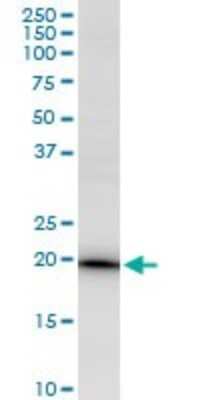 Western Blot: EEF1E1 Antibody [H00009521-B01P]