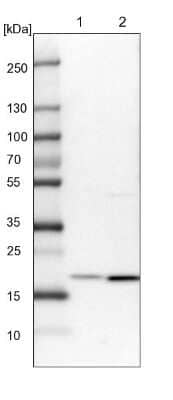 Western Blot: EEF1E1 Antibody [NBP1-89186]