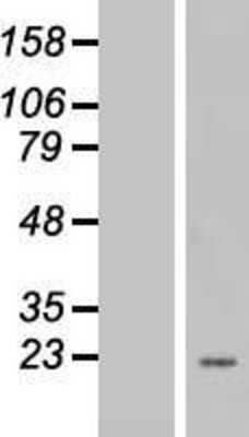 Western Blot: EEF1E1 Overexpression Lysate [NBL1-10126]