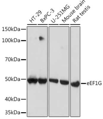 Western Blot: EEF1G Antibody (2E1O7) [NBP3-16694]