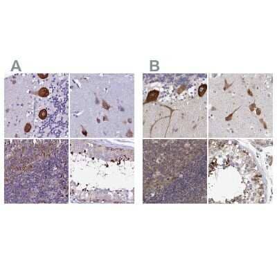 Immunohistochemistry-Paraffin: EEF1G Antibody [NBP1-91862]