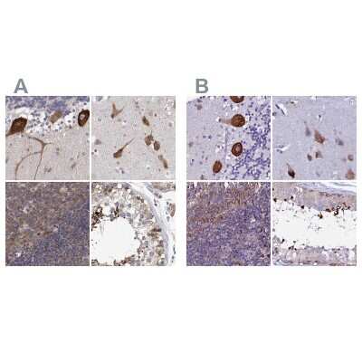Immunohistochemistry-Paraffin: EEF1G Antibody [NBP2-68716]