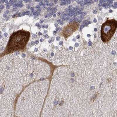 Immunohistochemistry-Paraffin: EEF1G Antibody [NBP2-68716]