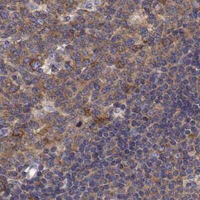 Immunohistochemistry-Paraffin: EEF1G Antibody [NBP2-68716]