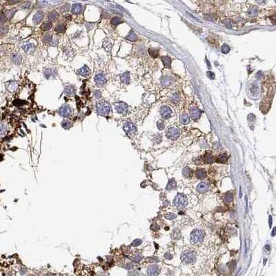 Immunohistochemistry-Paraffin: EEF1G Antibody [NBP2-68716]