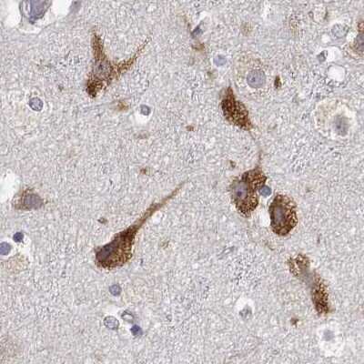 Immunohistochemistry-Paraffin: EEF1G Antibody [NBP2-68716]