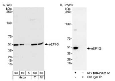 Western Blot: EEF1G Antibody [NB100-2262]