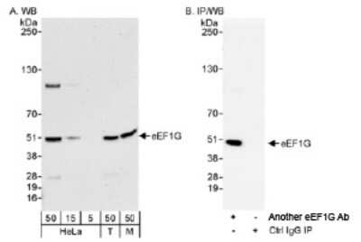 Western Blot: EEF1G Antibody [NB100-2263]