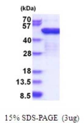 SDS-PAGE: Recombinant Human EEF1G His Protein [NBP2-51775]