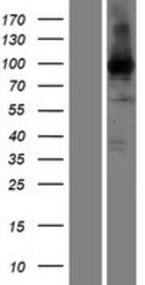 Western Blot: eEF-2 Overexpression Lysate [NBP2-08160]