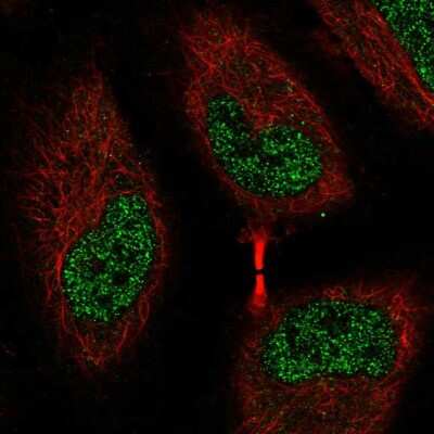 Immunocytochemistry/ Immunofluorescence: EEF2K Antibody [NBP2-58790]