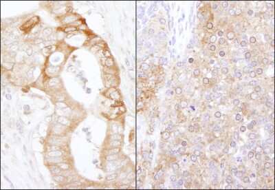 Immunohistochemistry-Paraffin: EEF2K Antibody [NB100-87019]
