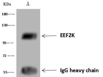 Immunoprecipitation: EEF2K Antibody [NBP3-12694]