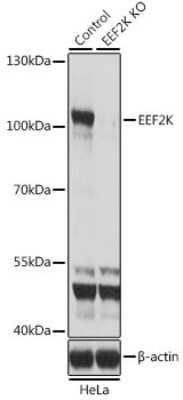 Knockout Validated: EEF2K Antibody - BSA Free [NBP2-92950]