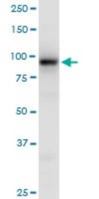 Western Blot: EEF2K Antibody [H00029904-B01P]