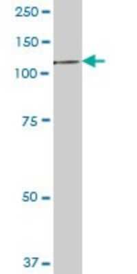 Western Blot: EEF2K Antibody [H00029904-B01P]