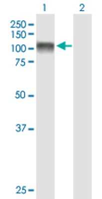 Western Blot: EEF2K Antibody [H00029904-B01P]
