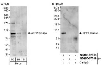 Western Blot: EEF2K Antibody [NB100-87019]