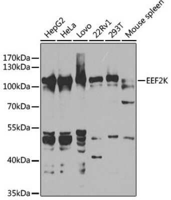 Western Blot: EEF2K AntibodyBSA Free [NBP2-92950]