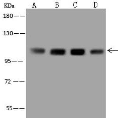 Western Blot: EEF2K Antibody [NBP3-12694]