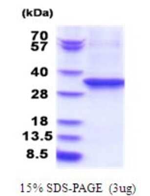 SDS-PAGE: Recombinant Human eEF-2 His Protein [NBP2-51776]