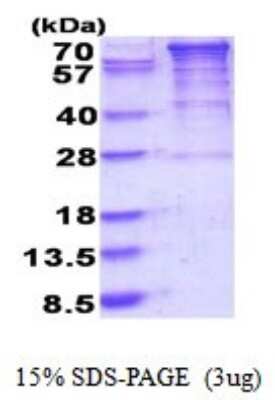 SDS-PAGE: Recombinant Human EEF2K His Protein [NBP2-51848]