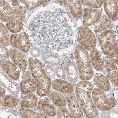 Immunohistochemistry-Paraffin: EEFSEC Antibody [NBP1-83992]