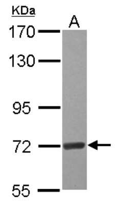 Western Blot: EEFSEC Antibody [NBP2-16275]