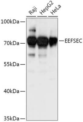 Western Blot: EEFSEC AntibodyAzide and BSA Free [NBP2-92380]