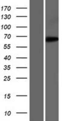 Western Blot: EEFSEC Overexpression Lysate [NBP2-06500]