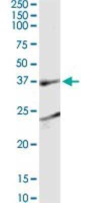 Western Blot: EEN Antibody (1B8) [H00006455-M05]