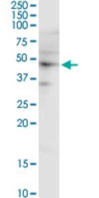 Western Blot: EEN Antibody (2B5) [H00006455-M02]