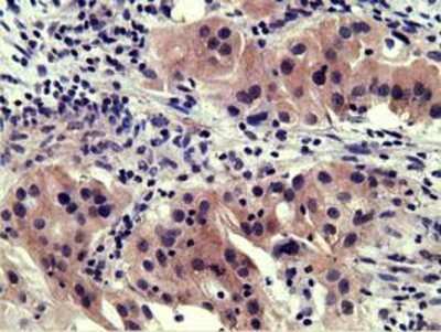 Immunohistochemistry-Paraffin: EEN Antibody (OTI2F5) [NBP2-02834]