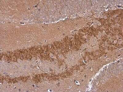 Immunohistochemistry-Paraffin: EEN Antibody (GT3065) [NBP3-13631]