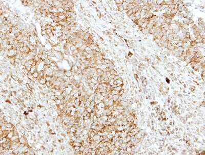 Immunohistochemistry-Paraffin: EEN Antibody [NBP1-33545]
