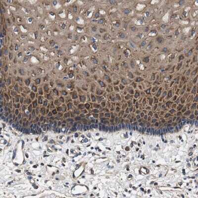 Immunohistochemistry-Paraffin: EEN Antibody [NBP1-85522]