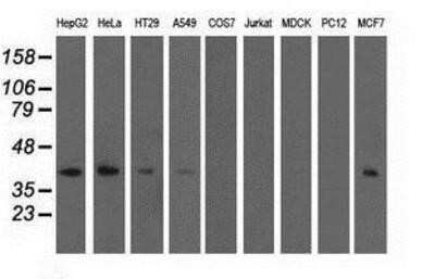 Western Blot: EEN Antibody (OTI2F5)Azide and BSA Free [NBP2-71279]