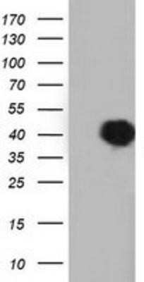 Western Blot: EEN Antibody (OTI2F5)Azide and BSA Free [NBP2-71279]