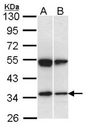 Western Blot: EEN Antibody [NBP1-33545]