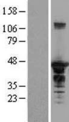 Western Blot: EEN Overexpression Lysate [NBL1-15932]