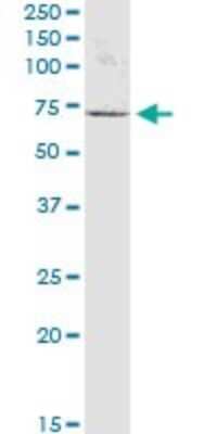 Western Blot: EEPD1 Antibody [H00080820-B03P]