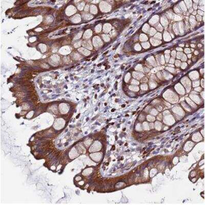Immunohistochemistry: EF-Hand Calcium Binding Domain 8 Antibody [NBP2-30742]
